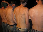 Sting pong injuries in Salta